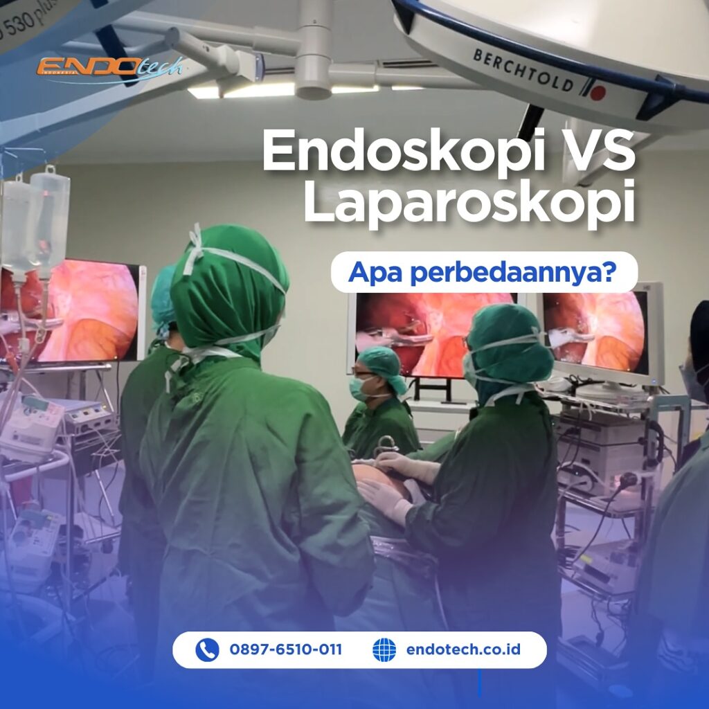 Beda Endoskopi dan Laparaskopi