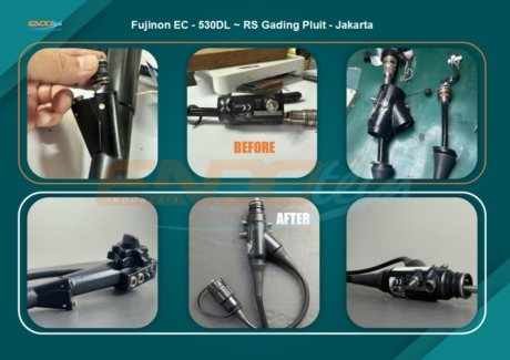 Fujinon EC - 530DL ~ RS Gading Pluit - Jakarta