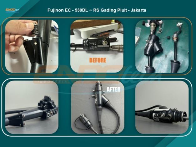 Fujinon EC - 530DL ~ RS Gading Pluit - Jakarta