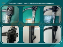 Fujinon EC - 530WL ~ RSUP Wahidin - Makasar