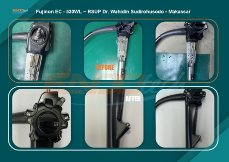 Fujinon EC - 530WL ~ RSUP Wahidin - Makasar