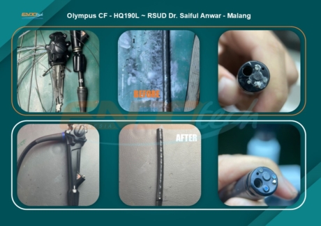 Olympus CF - HQ190L ~ RSUD Dr. Saiful Anwar - Malang