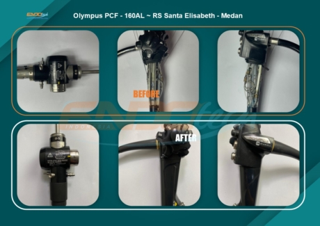 Olympus PCF - 160AL ~ RS Santa Elisabeth - Medan