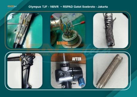 Olympus TJF - 160VR ~ RSPAD Gatot Soebroto - Jakarta