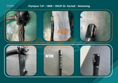 Olympus TJF - 180B RSUP Dr. Kariadi - Semarang