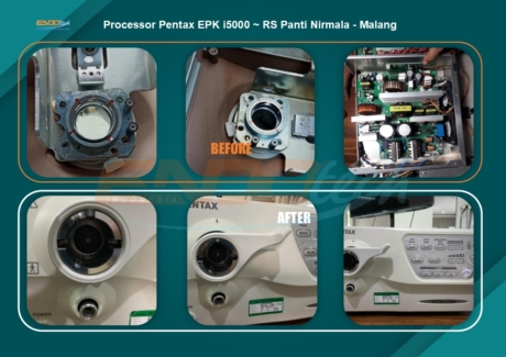 Processor Pentax EPK i5000 ~ RS Panti Nirmala - Malang